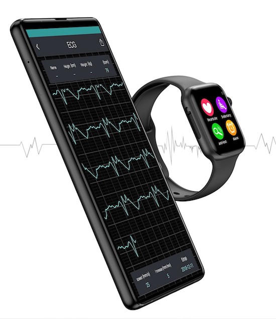 xwatch smartwatch